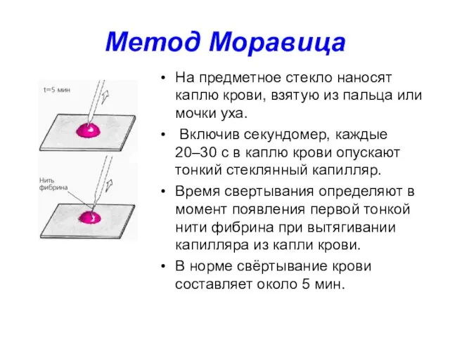 Метод Моравица На предметное стекло наносят каплю крови, взятую из пальца