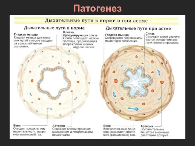 Патогенез