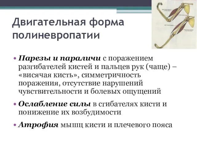 Двигательная форма полиневропатии Парезы и параличи с поражением разгибателей кистей и