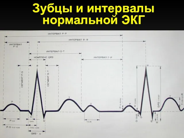 Зубцы и интервалы нормальной ЭКГ