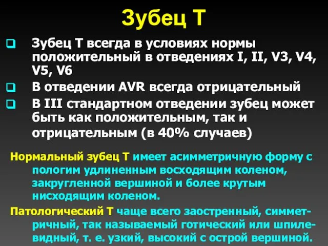 Зубец Т Зубец T всегда в условиях нормы положительный в отведениях