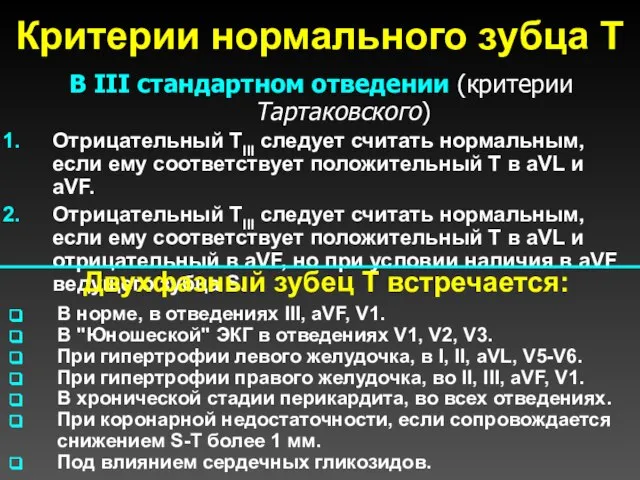 Критерии нормального зубца Т В III стандартном отведении (критерии Тартаковского) Отрицательный