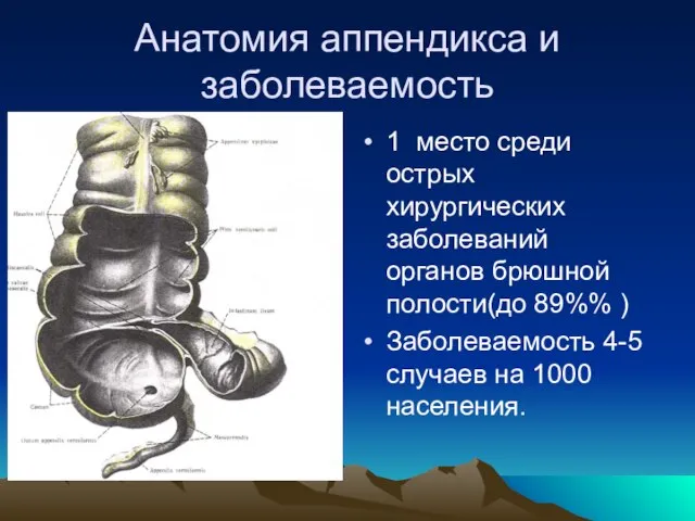 Анатомия аппендикса и заболеваемость 1 место среди острых хирургических заболеваний органов