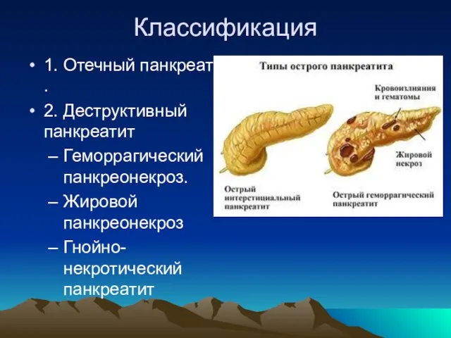 Классификация 1. Отечный панкреатит . 2. Деструктивный панкреатит Геморрагический панкреонекроз. Жировой панкреонекроз Гнойно-некротический панкреатит