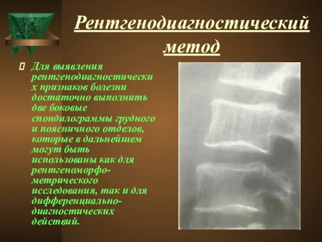 Рентгенодиагностический метод Для выявления рентгенодиагностических признаков болезни достаточно выполнить две боковые