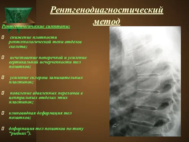 Рентгенодиагностический метод Рентгенологические симптомы: снижение плотности рентгенологической тени отделов скелета; исчезновение