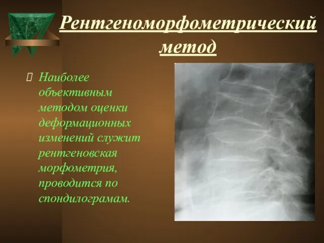 Рентгеноморфометрический метод Наиболее объективным методом оценки деформационных изменений служит рентгеновская морфометрия,проводится по спондилограмам.