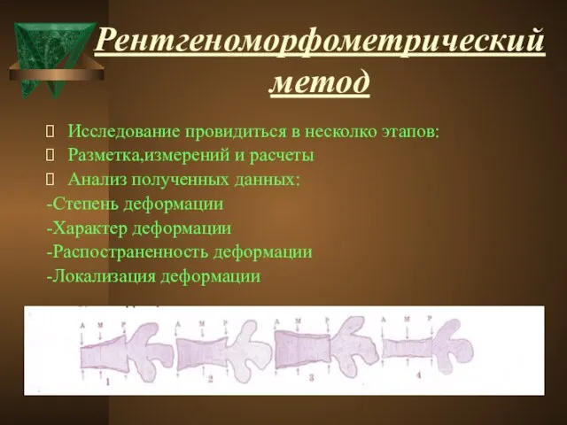 Рентгеноморфометрический метод Исследование провидиться в несколко этапов: Разметка,измерений и расчеты Анализ