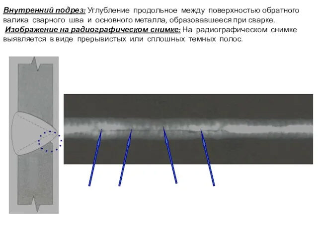 Внутренний подрез: Углубление продольное между поверхностью обратного валика сварного шва и