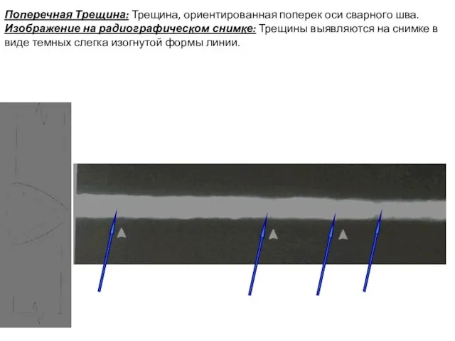 Поперечная Трещина: Трещина, ориентированная поперек оси сварного шва. Изображение на радиографическом