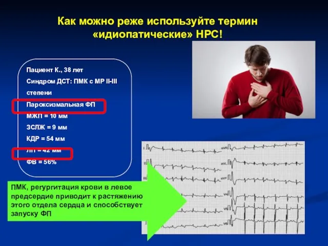 Пациент К., 38 лет Синдром ДСТ: ПМК с МР II-III степени