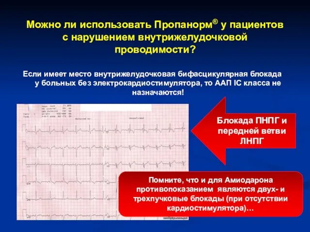 Если имеет место внутрижелудочковая бифасцикулярная блокада у больных без электрокардиостимулятора, то