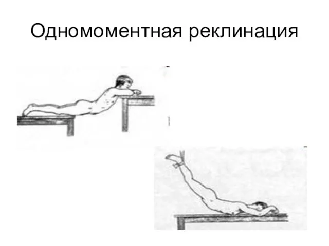 Одномоментная реклинация