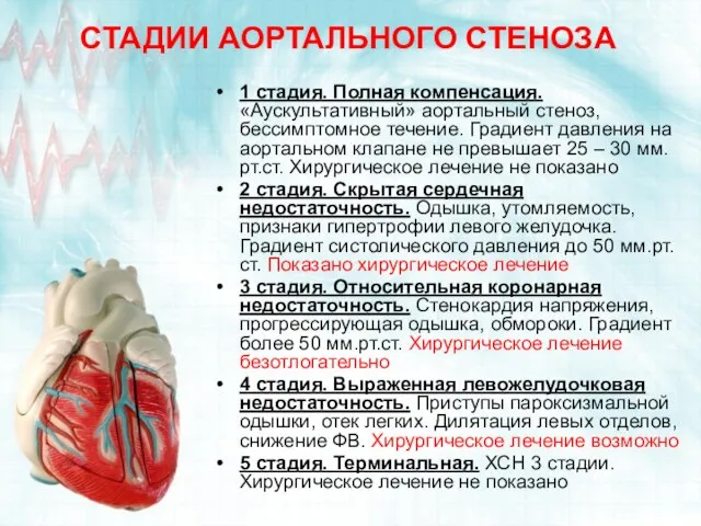 СТАДИИ АОРТАЛЬНОГО СТЕНОЗА 1 стадия. Полная компенсация. «Аускультативный» аортальный стеноз, бессимптомное