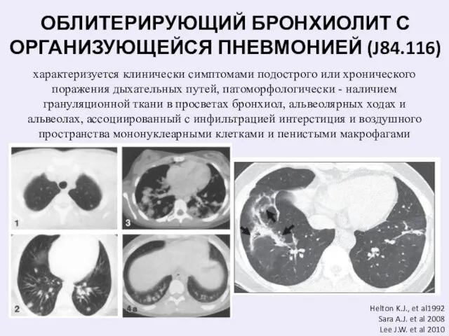 характеризуется клинически симптомами подострого или хронического поражения дыхательных путей, патоморфологически -