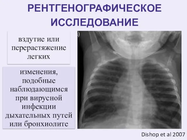 РЕНТГЕНОГРАФИЧЕСКОЕ ИССЛЕДОВАНИЕ Dishop et al 2007