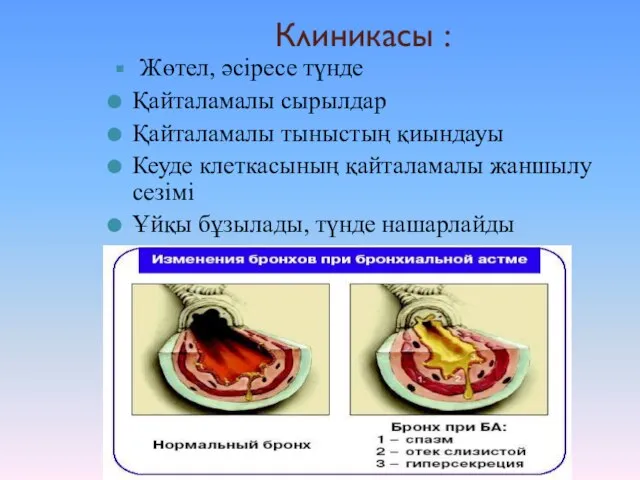 Клиникасы : Жөтел, әсіресе түнде Қайталамалы сырылдар Қайталамалы тыныстың қиындауы Кеуде