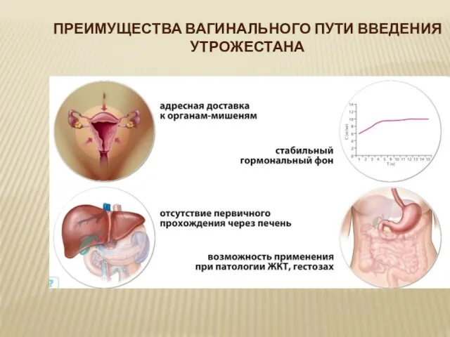 ПРЕИМУЩЕСТВА ВАГИНАЛЬНОГО ПУТИ ВВЕДЕНИЯ УТРОЖЕСТАНА