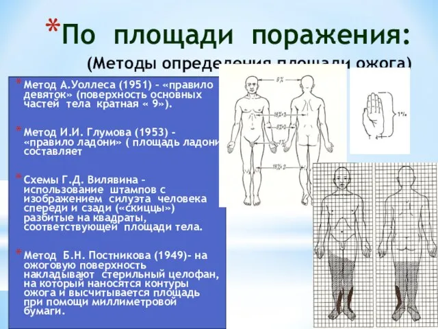 По площади поражения: (Методы определения площади ожога) Метод А.Уоллеса (1951) –