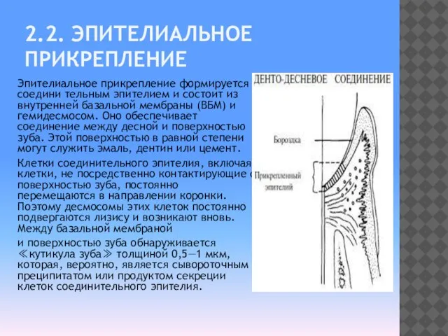 2.2. ЭПИТЕЛИАЛЬНОЕ ПРИКРЕПЛЕНИЕ Эпителиальное прикрепление формируется соедини тельным эпителием и состоит