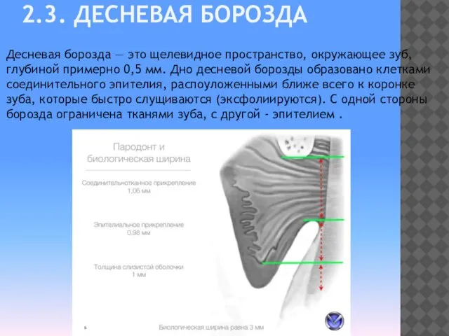 2.3. ДЕСНЕВАЯ БОРОЗДА Десневая борозда — это щелевидное пространство, окружающее зуб,