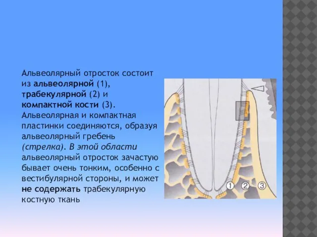 Альвеолярный отросток состоит из альвеолярной (1), трабекулярной (2) и компактной кости