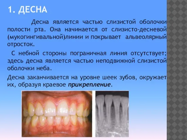 1. ДЕСНА Десна является частью слизистой оболочки полости рта. Она начинается