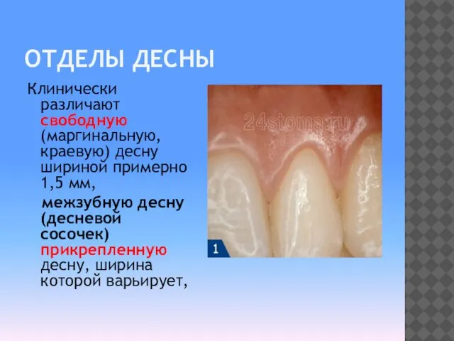 ОТДЕЛЫ ДЕСНЫ Клинически различают свободную (маргинальную, краевую) десну шириной примерно 1,5