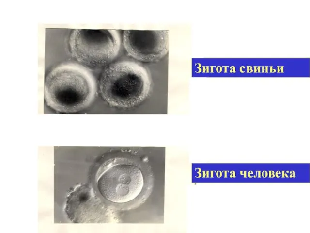 Зигота человека Зигота свиньи