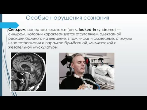 Особые нарушения сознания Синдром «запертого человека» (англ. locked-in syndrome) — синдром,