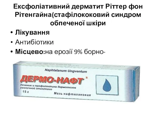 Ексфоліативний дерматит Ріттер фон Рітенгайна(стафілококовий синдром обпеченої шкіри Лікування Антибіотики Місцево:на ерозії 9% борно-нафталанову,