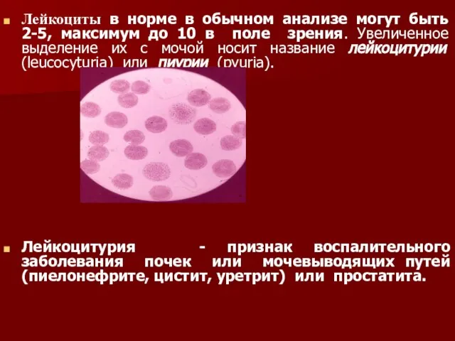 Лейкоциты в норме в обычном анализе могут быть 2-5, максимум до