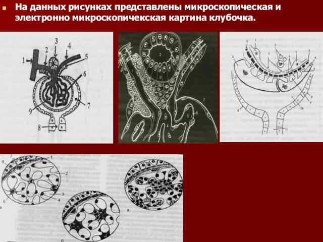 На данных рисунках представлены микроскопическая и электронно микроскопичекская картина клубочка.