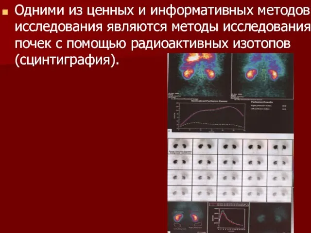 Одними из ценных и информативных методов исследования являются методы исследования почек с помощью радиоактивных изотопов (сцинтиграфия).