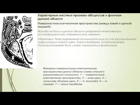 Характерные местные признаки абсцессов и флегмон щечной области Поверхностное клетчаточное пространство