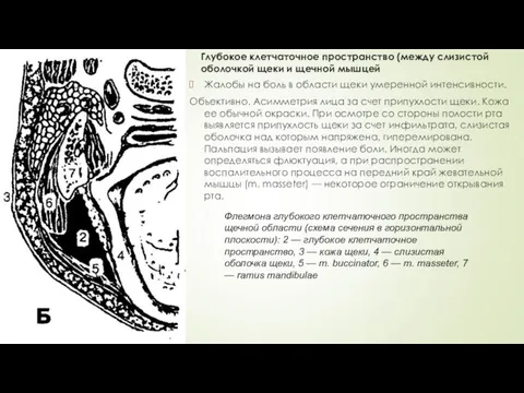 Глубокое клетчаточное пространство (между слизистой оболочкой щеки и щечной мышцей Жалобы