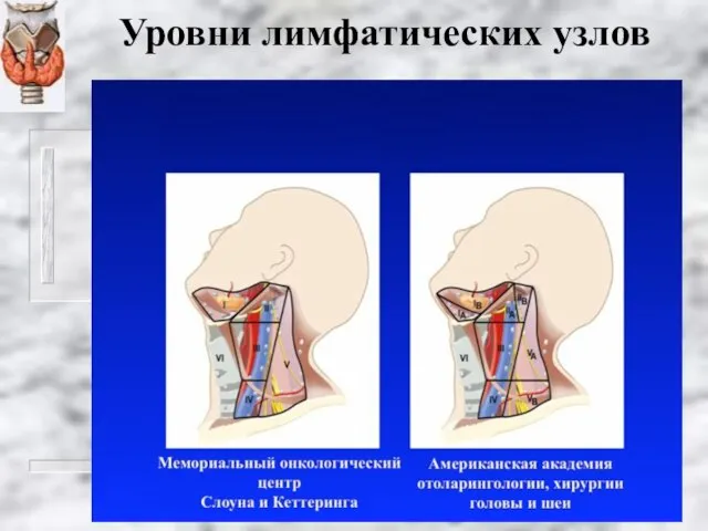 Уровни лимфатических узлов