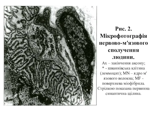 Рис. 2. Мікрофотографія нервово-м′язового сполучення людини. Ах – закінчення аксону; *