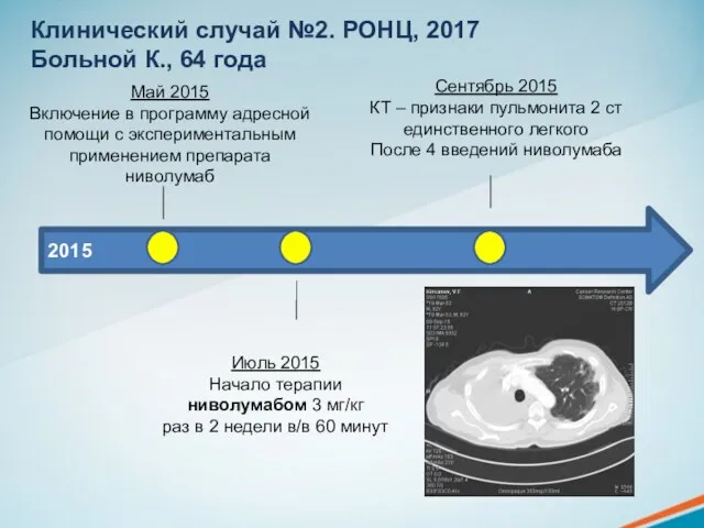 Клинический случай №2. РОНЦ, 2017 Больной К., 64 года 2015 Май