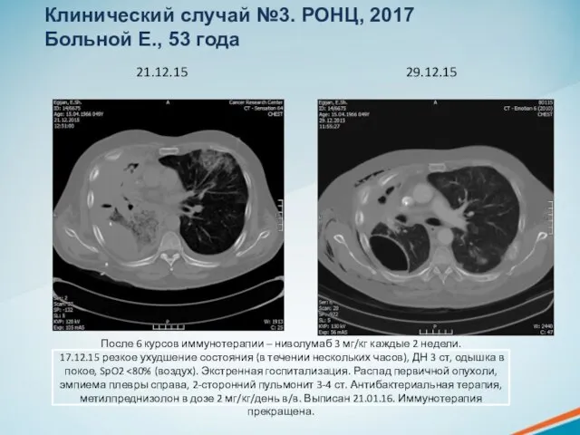 После 6 курсов иммунотерапии – ниволумаб 3 мг/кг каждые 2 недели.