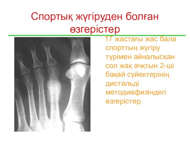 Спортық жүгіруден болған өзгерістер 17 жастағы жас бала спорттың жүгіру түрімен