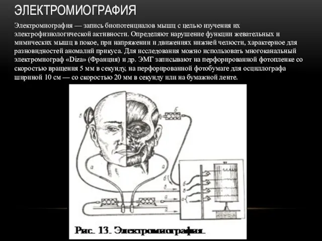 ЭЛЕКТРОМИОГРАФИЯ Электромиография — запись биопотенциалов мышц с целью изучения их электрофизиологической