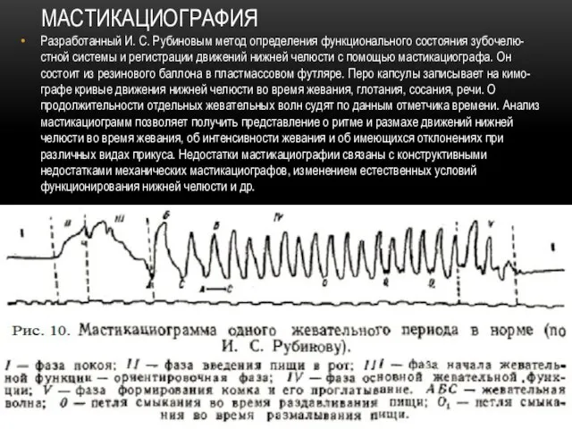 МАСТИКАЦИОГРАФИЯ Разработанный И. С. Рубиновым метод определения функционального состояния зубочелю-стной системы