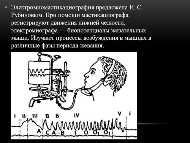 Электромиомастикациография предложена И. С. Рубиновым. При помощи мастикациографа регистрируют движения нижней