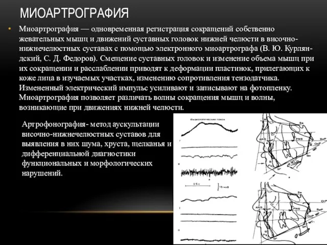 МИОАРТРОГРАФИЯ Миоартрография — одновременная регистрация сокращений собственно жевательных мышц и движений