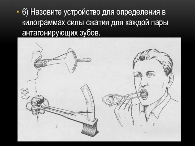 6) Назовите устройство для определения в килограммах силы сжатия для каждой пары антагонирующих зубов.