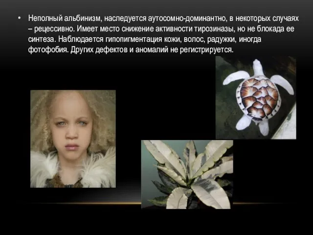 Неполный альбинизм, наследуется аутосомно-доминантно, в некоторых случаях – рецессивно. Имеет место