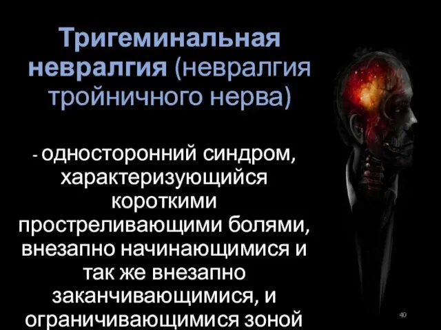 Тригеминальная невралгия (невралгия тройничного нерва) - односторонний синдром, характеризующийся короткими простреливающими