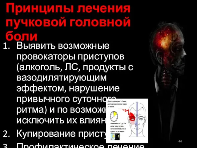 Принципы лечения пучковой головной боли Выявить возможные провокаторы приступов (алкоголь, ЛС,