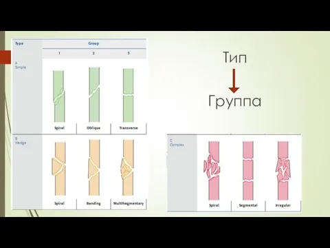 Тип Группа